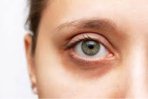 INFINITE*BRIGHT EYES (Eye Serum)