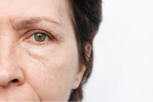 INFINITE*BRIGHT EYES (Eye Serum)