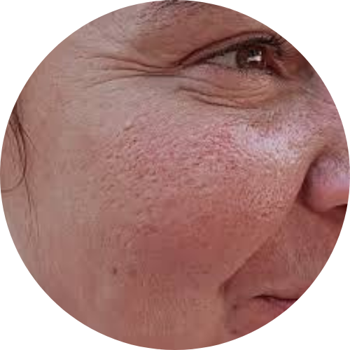 Rough skin