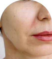 KANSA GUA SHA