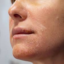 (HYDRATION)² - Hyaluronic Acid Serum